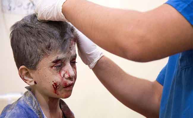 مرة أخرى، حلب تحت القصف