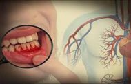 9 أساليب منزلية تخلصكم من مشاكل اللثة المزعجة!