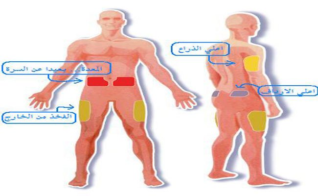 ما هي أفضل أماكن لحقن الأنسولين في الجسم؟