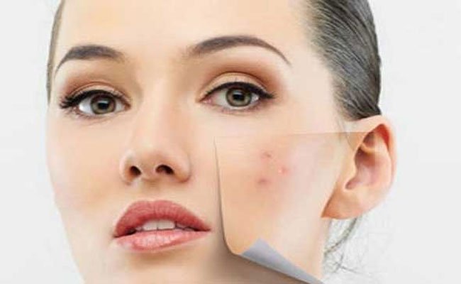 4 وصفات طبيعية كفيلة بإعادة النضارة لبشرتك!