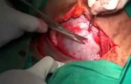 طاقم طبي يتم جره للمحاكمة بعد أن نسي ضمادة في رحم سيدة أجرت عملية قيصرية  للولادة!