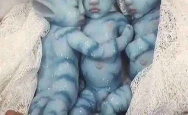 بينما الغرب يكتشفون الفضاء فان في اليمن جدل كبير حول أطفال الجن