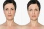 أمام المحكمة شخص يسكب مادة حارقة على وجه زوجته