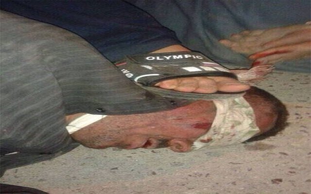 منظمة العفو الدولية قوات البشمركة الكردية والفصائل الشيعية قاموا بجرائم حرب في الموصل