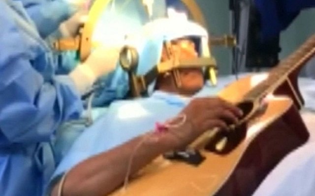 فنان يعزف على الجيتار أثناء خضوعه لعملية جراحية دقيقة في الدماغ