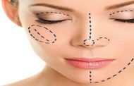 هكذا تتم عملية رفع الشفاه في أقل من ساعة!