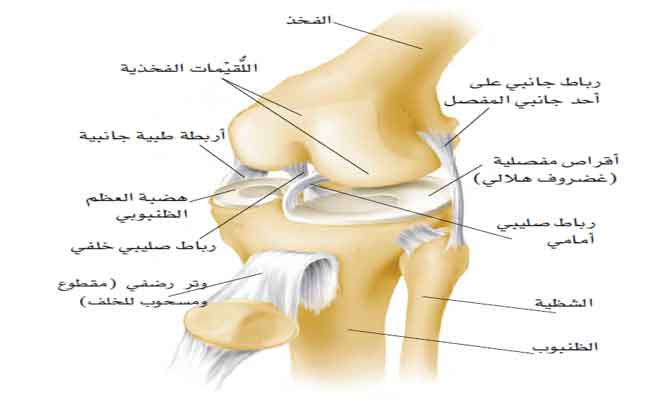 لتخلص من آلام الركبة نهائياً... هل بات ممكناً؟