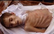 حصار حزب الله ومعه المليشيات الشيعية للغوطة الشرقية يتسبب في قتل مئات الأطفال