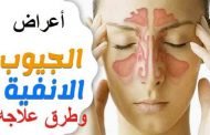 كيف تواجهين صداع الجيوب الأنفية؟
