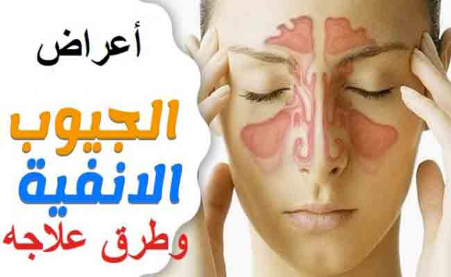 كيف تواجهين صداع الجيوب الأنفية؟