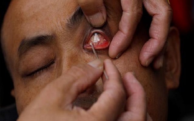 حلاق يقشر جفون زبائنه من الداخل مقابل 12 دولار