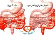 كيف يمكن علاج التهاب الامعاء؟