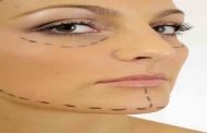 هذا ما يجب ان تعرفيه عن حشو التجاعيد بالحقن!