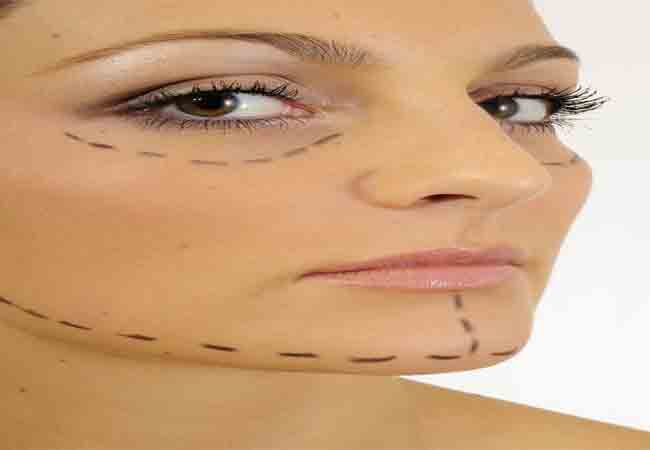 هذا ما يجب ان تعرفيه عن حشو التجاعيد بالحقن!