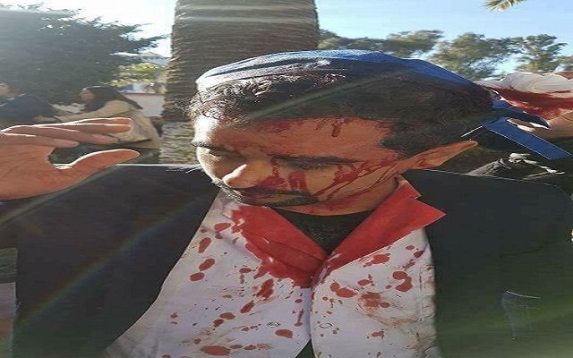 حكومة اويحيى تنهج مع الأطباء سياسة الأذان الصماء والعصا بدل الحوار