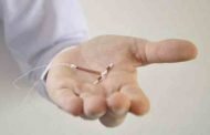 5 حقائق هامّة يجب معرفتها عن اللولب لمنع الحمل