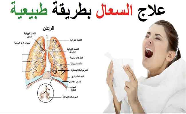 هل يمكن معالجة السعال الجاف منزلياً؟