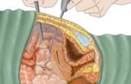 طبّقي تمارين كيجل للتخلّص من مشكلة البواسير!