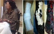 متسولة تخدع ضحاياها مستغلة موهبتها في رسم تشوهات على قدمها