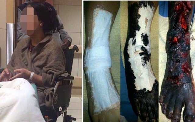 متسولة تخدع ضحاياها مستغلة موهبتها في رسم تشوهات على قدمها