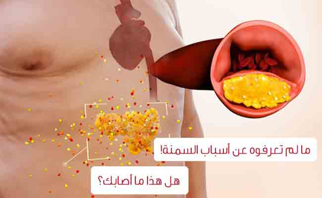 هل السُّمنة حقاً تعتبر من مسبّبات السرطان؟