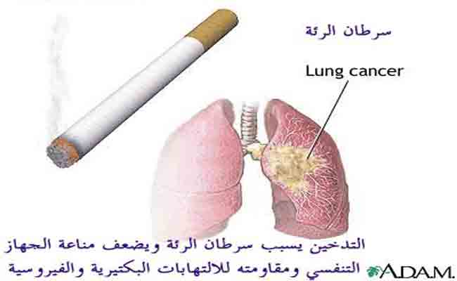كيف يؤثر التدخين على الجهاز الهضمي؟