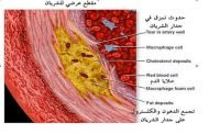 هل لديكم تساؤلات حول مميعات الدم؟