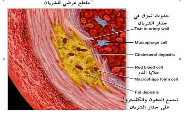 هل لديكم تساؤلات حول مميعات الدم؟