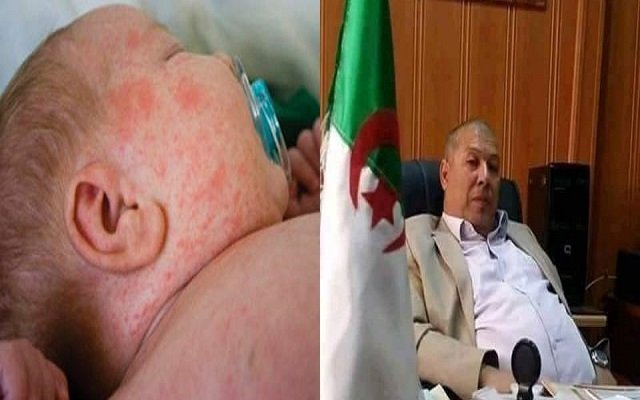 18 شهرا لنجم فديوهات رأس الماء/ وحالة وفاة بسبب البوحمرون