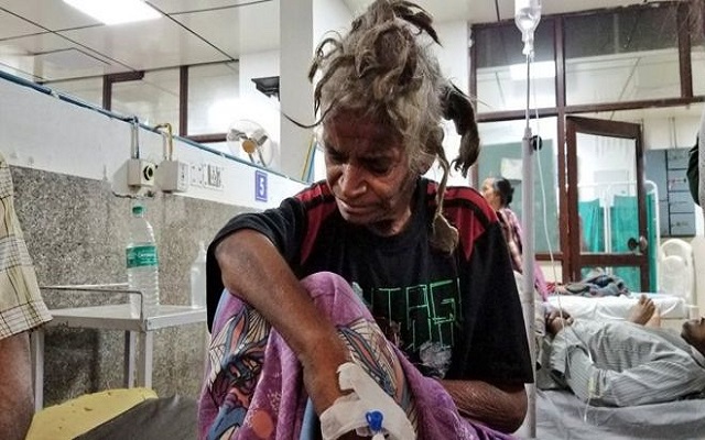 القبض على حيوان حبس أخته لمدة عامين وعذبها بشكل وحشي