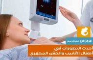 هذه التقنيات هي الأحدث والأكثر تطوّراً في عمليات طفل الأنبوب