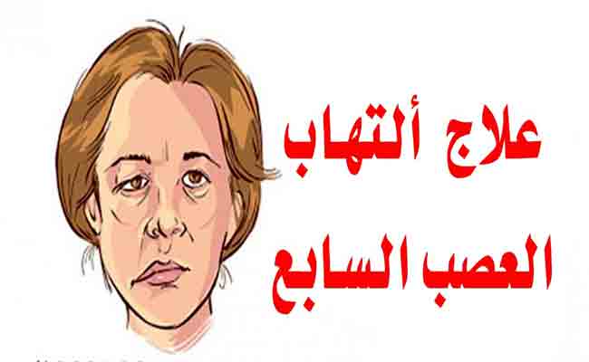كيف يتم علاج التهاب العصب السابع؟