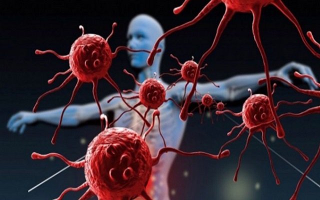 مرض العصر يفتك بحياة أكثر من 50 ألف جزائري سنويا