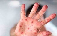 تسجيل إصابة 23 ألف شخص بالبوحمرون خلال 2018 منها 16 وفاة