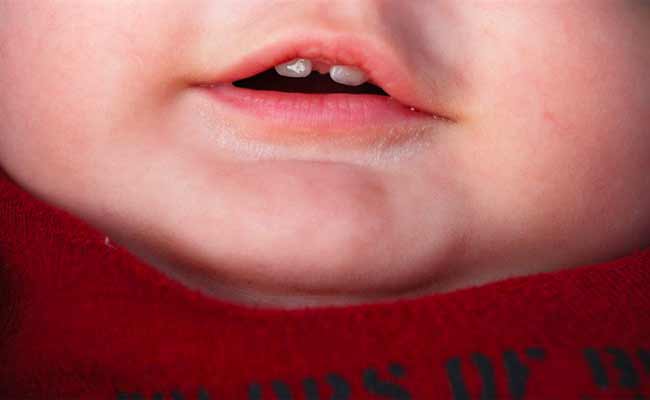 كيف تكتشفين أن موعد تسنين طفلك قد حان؟