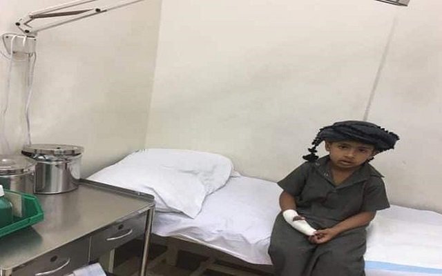 (الغباء) عندما يُبدع العرب ... تحدي حرق الاطفال