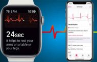 خدمة ECG : قريبا على ساعات أبل واتش في أوروبا