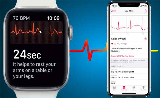 خدمة ECG : قريبا على ساعات أبل واتش في أوروبا