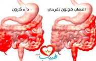 هل يمكن الحمل دون مشاكل مع مرض الكرون؟