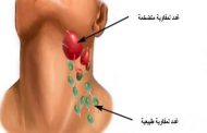ما هي أعراض التهاب الغدد اللمفاوية في الرقبة؟