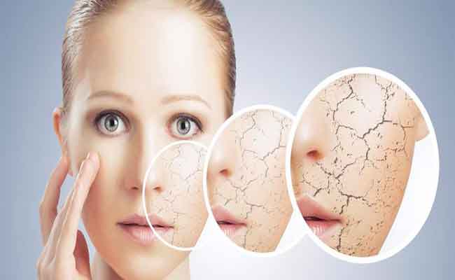 إبتعدي عن السكريات للحفاظ على بشرة نضرة!