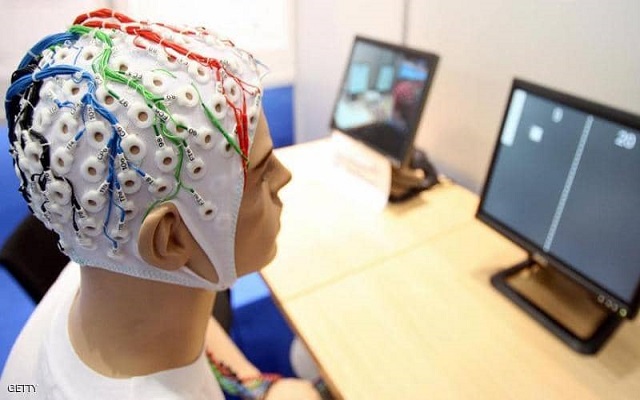 ما علاقة الصدمات الكهربائية بالذاكرة