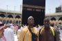 ما هي تشوّهات أصابع القدم الأكثر شيوعاً؟