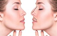 أهداف عملية تجميل الأنف...