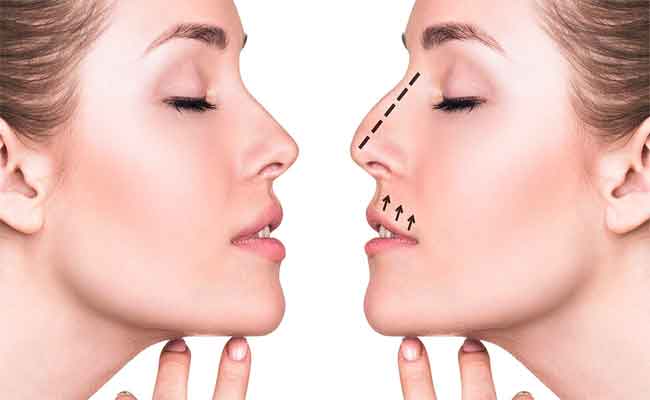 أهداف عملية تجميل الأنف...