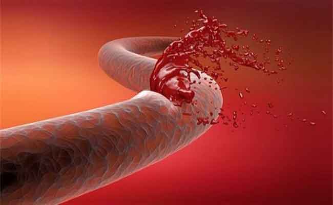 10 أسباب قد تقف وراء اصفرار الجلد... ما هي...؟