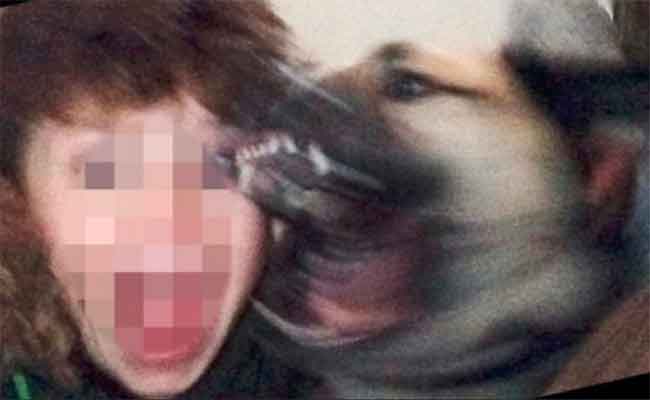 عضات كلب مسعور تنهي حياة طفل بوهران