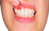 كيف تحمين نفسك من التهاب اللثة خلال الحمل...؟