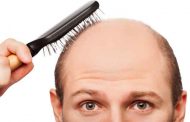 الصلع عند الرجال مشكلة مزعجة ... فكيف يمكن علاجها...؟