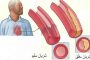 ترامب اعتقلوا رئيس لجنة المخابرات إنه خائن